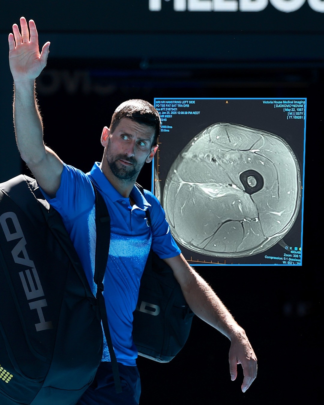 ATP总决赛碾压美网，德约科维奇刷新纪录